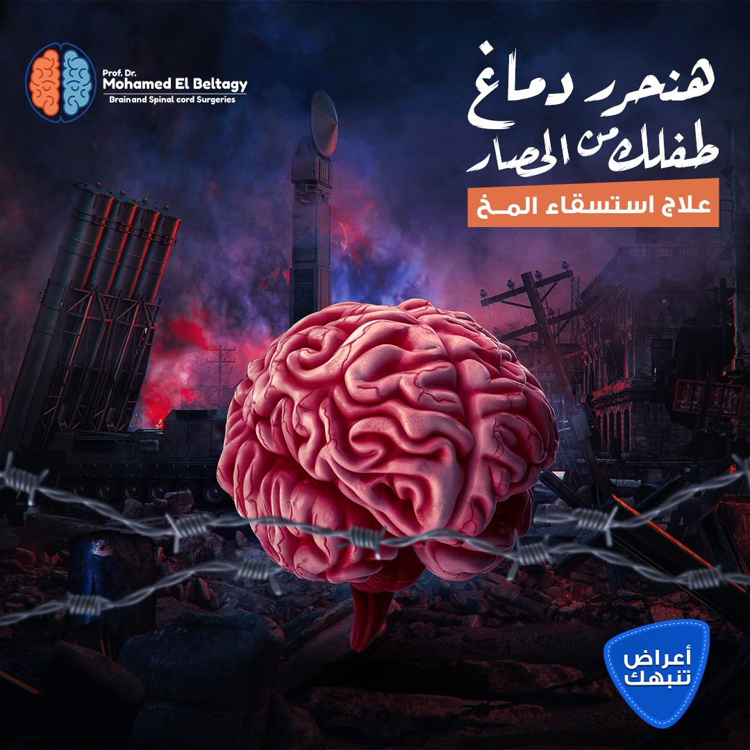 استسقاء المخ